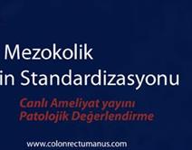 Kolon kanser tedavisinde multidisipliner yaklaşımı ve komplet mezokolik eksizyon tekniğinin standardizasyonu Kolon kanser tedavisinde multidisipliner yaklaşımı ve komplet mezokolik eksizyon tekniğinin standardizasyonu