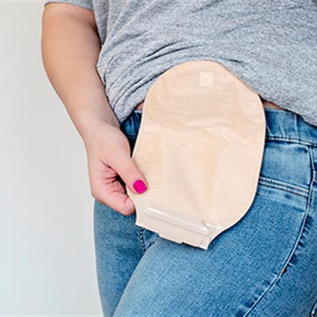 Stoma Bakımı Stoma Bakımı